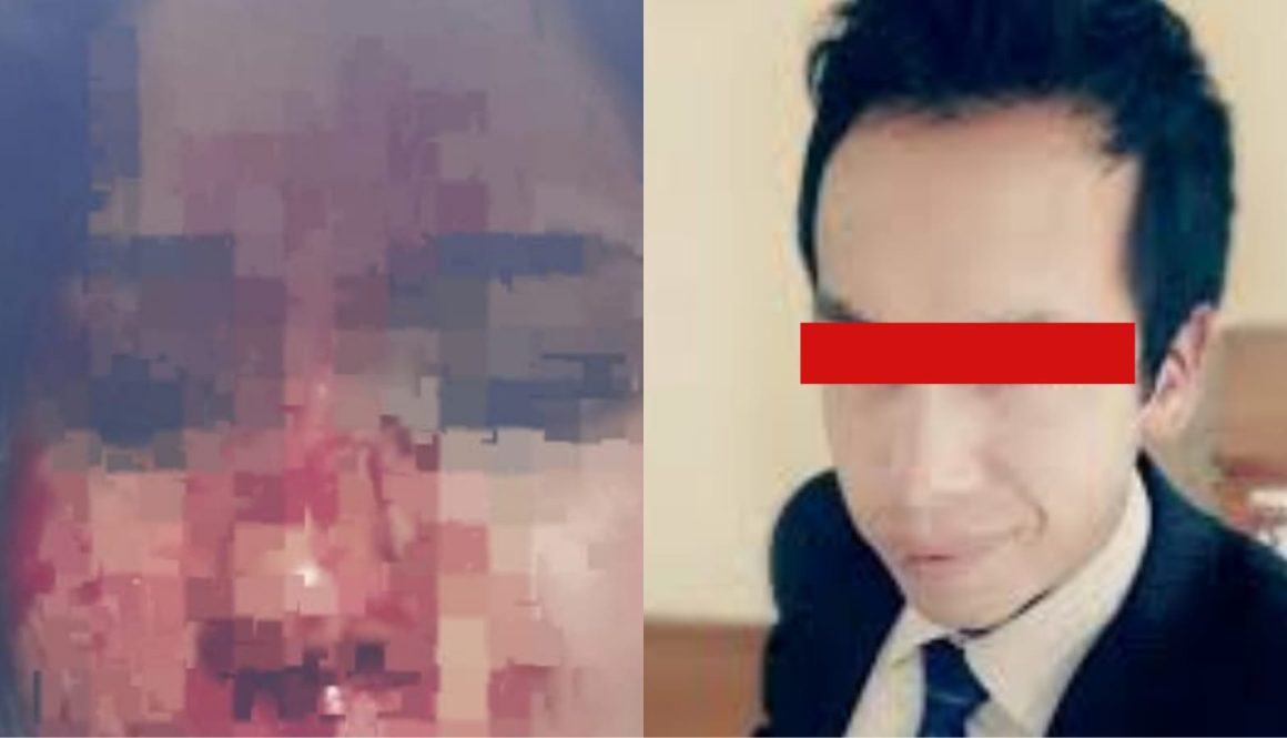 WhatsApp Image 2022-07-05 at 6.42.39 PM WhatsApp Image 2022-07-05 at 6.42.39 PM